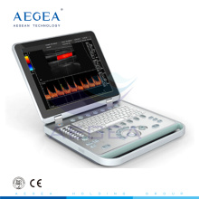 AG-BU005 Advanced and convenient hospital notebook color doppler ultrasound system